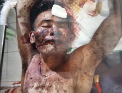 Warga Pendatang Diduga Gangguan Jiwa Mengamuk di Kuta, Diamuk Massa hingga Sekarat